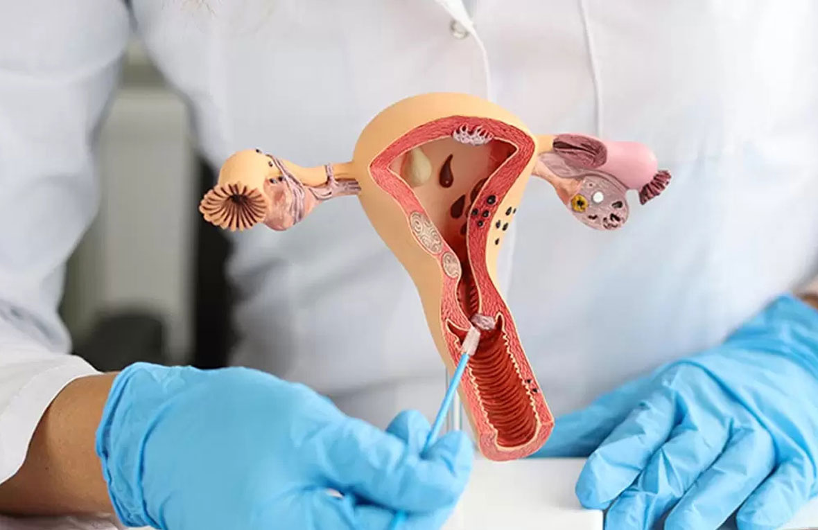 Smear Testi ve Tarama Testleri. Op.Dr Emrah Kızıldağ Kadın Doğum Doktoru